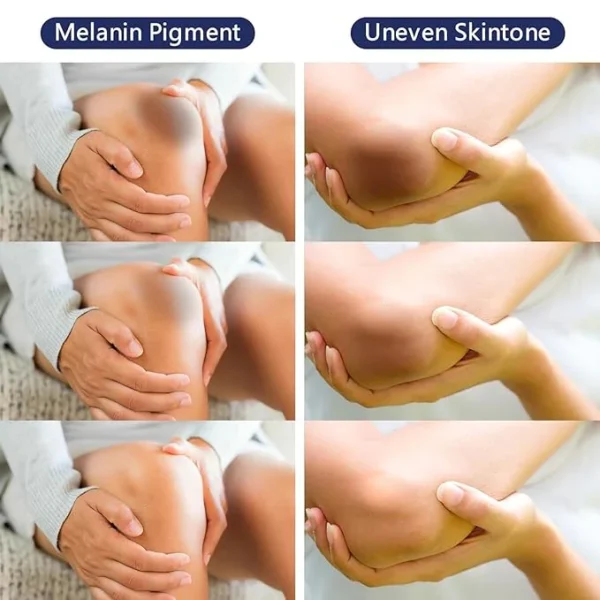 Whitening Cream For Dark Skin Area - Image 6