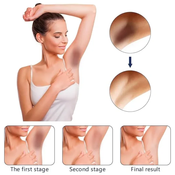 Whitening Cream For Dark Skin Area - Image 8