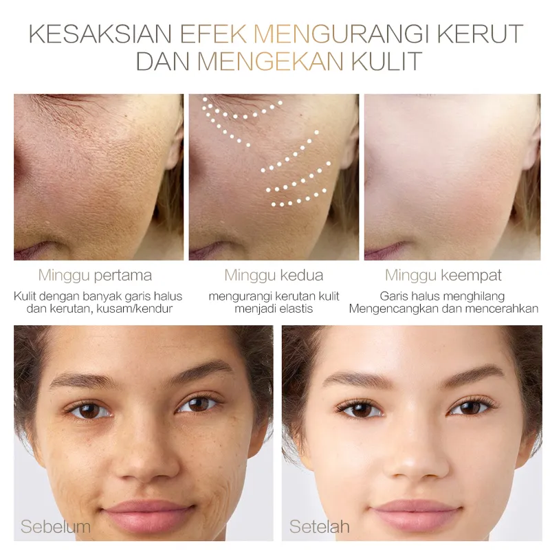 Chalonese Brightening Cream - Image 6