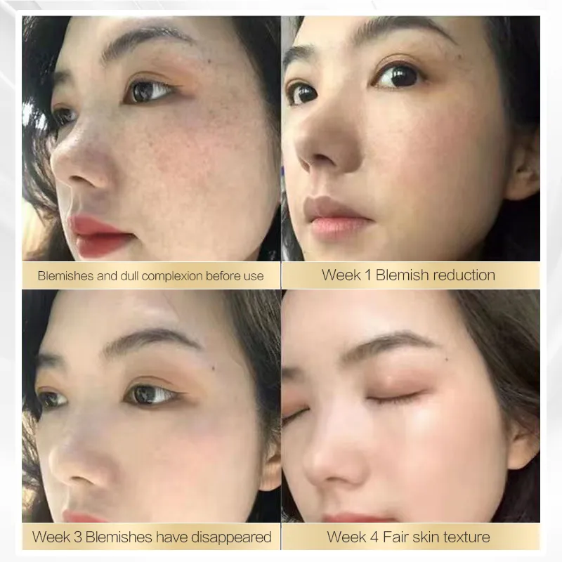 Chalonese Brightening Cream - Image 7