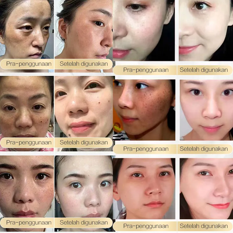 Chalonese Brightening Cream - Image 5